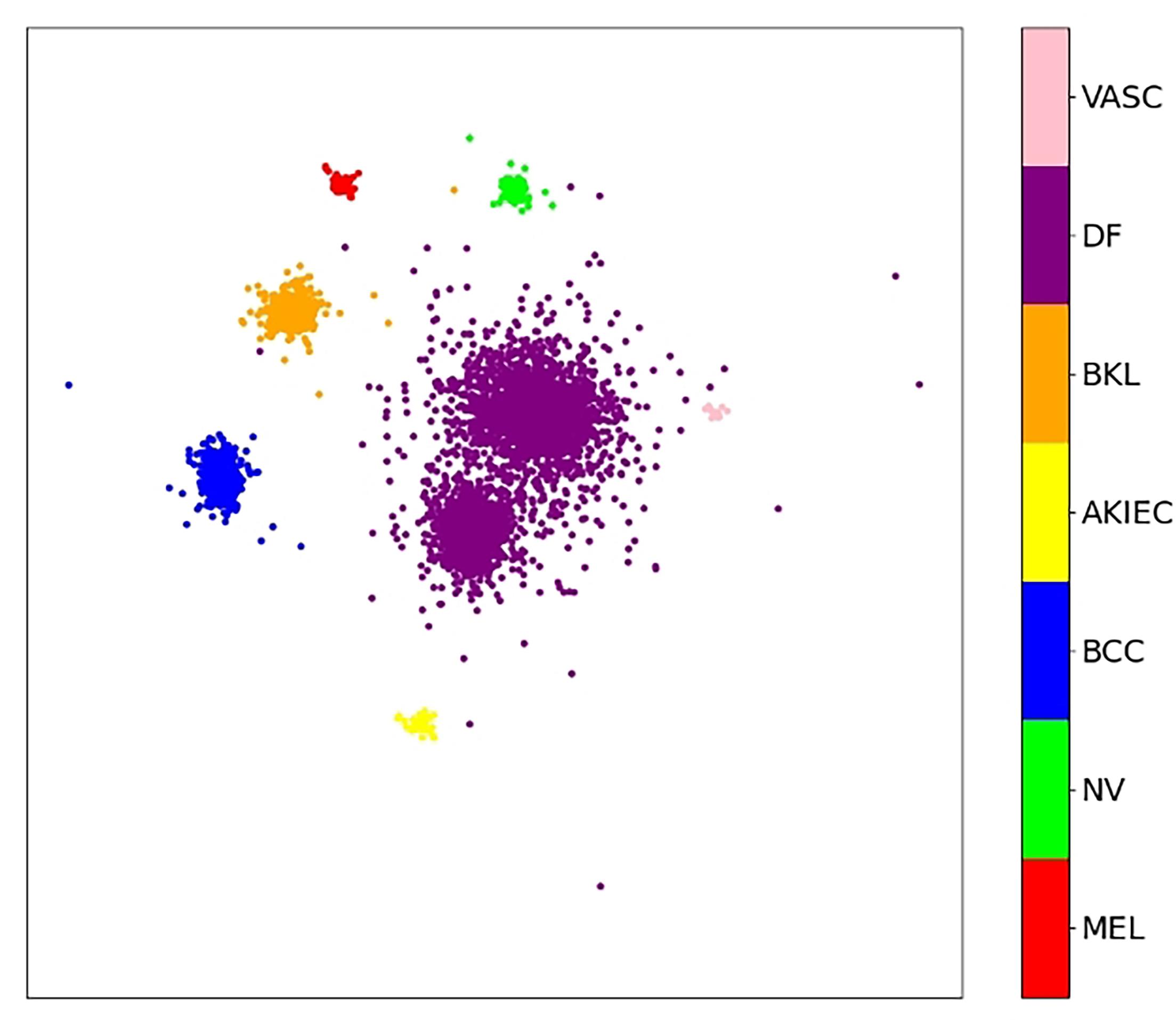 基于特征类内紧凑性的不平衡医学图像分类方法